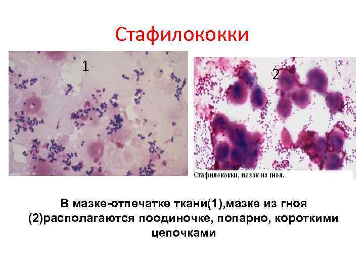    Стафилококки   1       2