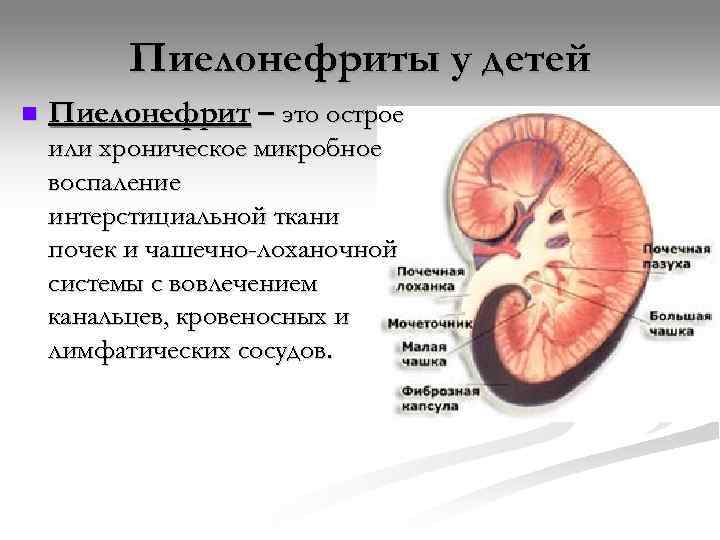    Пиелонефриты у детей n  Пиелонефрит – это острое или хроническое