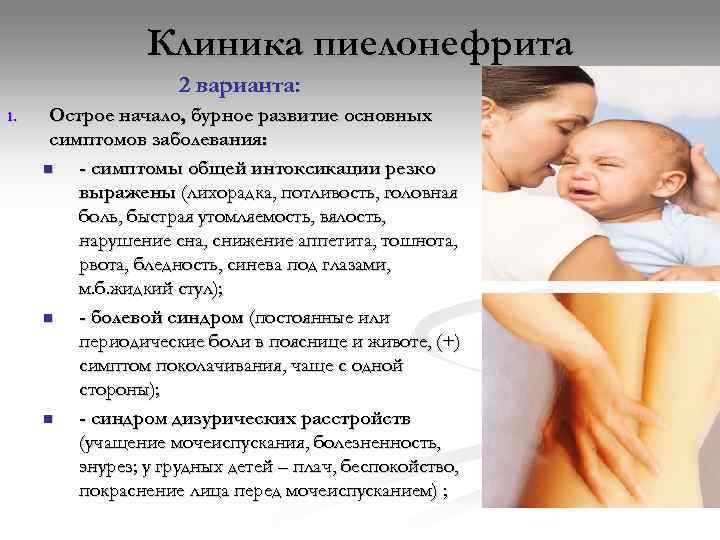    Клиника пиелонефрита     2 варианта: 1. Острое начало,