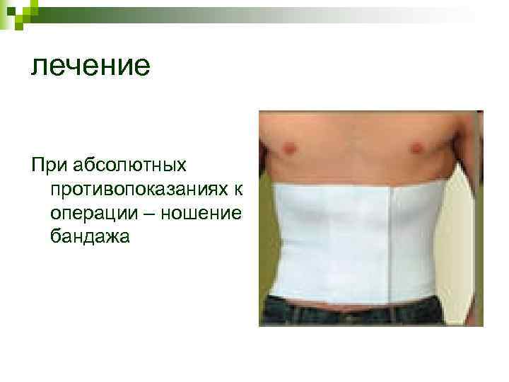 лечение При абсолютных противопоказаниях к операции – ношение бандажа лечение При абсолютных противопоказаниях к операции – ношение бандажа