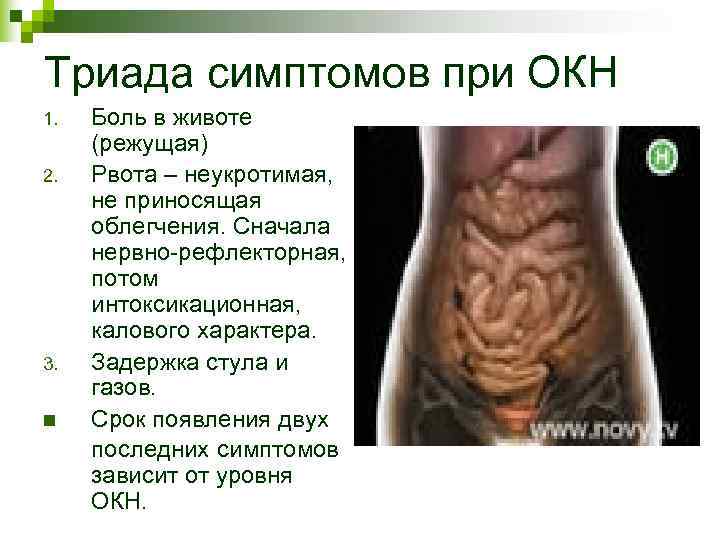 Триада симптомов при ОКН 1. Боль в животе (режущая) 2. Рвота – Триада симптомов при ОКН 1. Боль в животе (режущая) 2. Рвота –