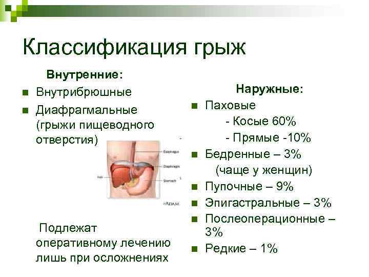 Прямую паховую грыжу характеризует слабость следующей стенки