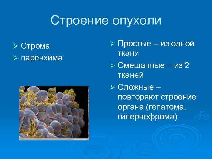  Строение опухоли Ø Строма Ø Простые – из одной ткани Ø паренхима Ø