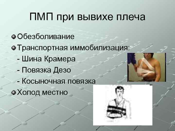  ПМП при вывихе плеча Обезболивание Транспортная иммобилизация: - Шина Крамера - Повязка Дезо