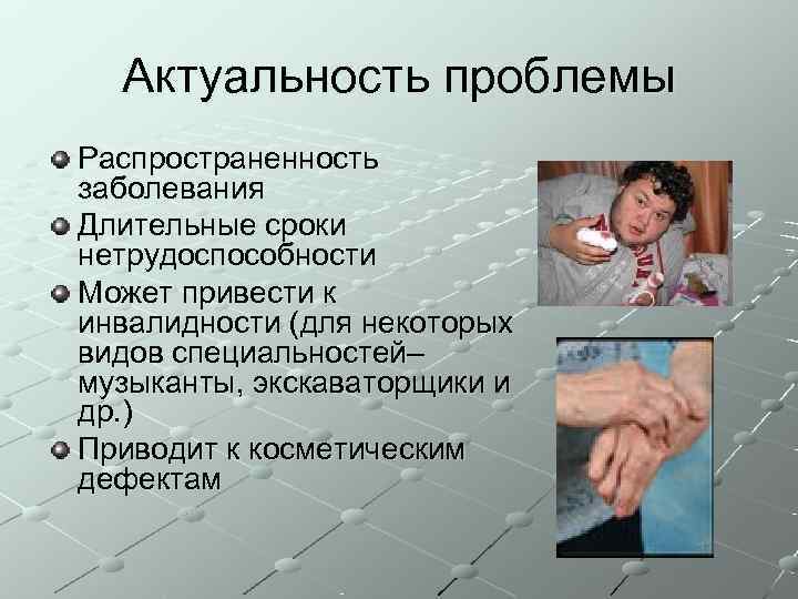  Актуальность проблемы Распространенность заболевания Длительные сроки нетрудоспособности Может привести к инвалидности (для некоторых