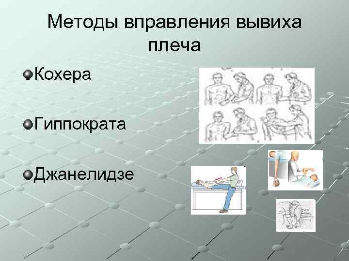  Методы вправления вывиха  плеча Кохера Гиппократа Джанелидзе 