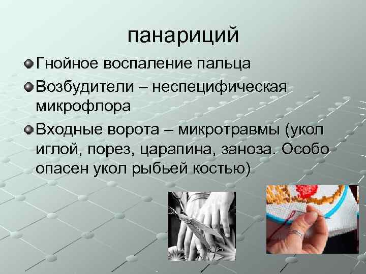   панариций Гнойное воспаление пальца Возбудители – неспецифическая микрофлора Входные ворота – микротравмы