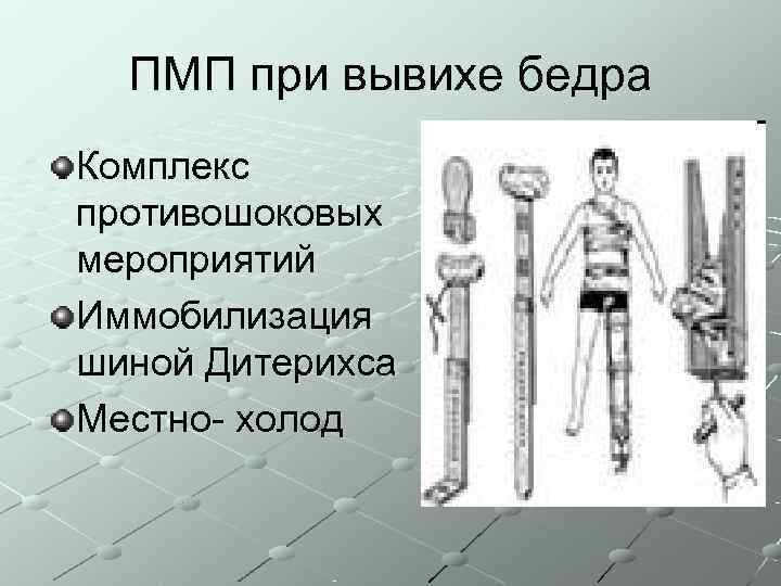  ПМП при вывихе бедра Комплекс противошоковых мероприятий Иммобилизация шиной Дитерихса Местно- холод 