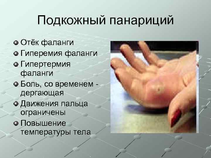   Подкожный панариций Отёк фаланги Гиперемия фаланги Гипертермия фаланги Боль, со временем -