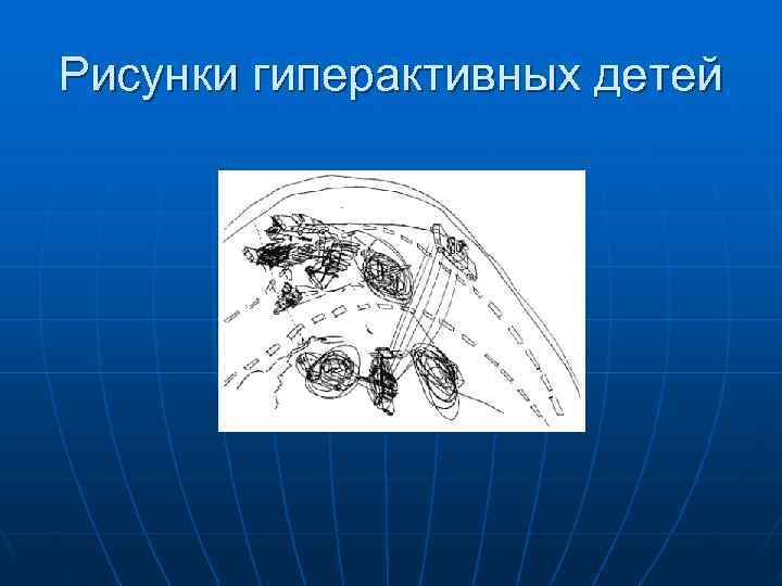 Рисунки гиперактивных детей 