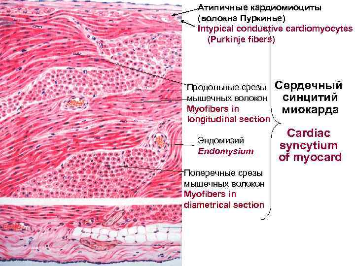  Атипичные кардиомиоциты (волокна Пуркинье) Intypical conductive cardiomyocytes (Purkinje fibers) Продольные срезы Сердечный мышечных