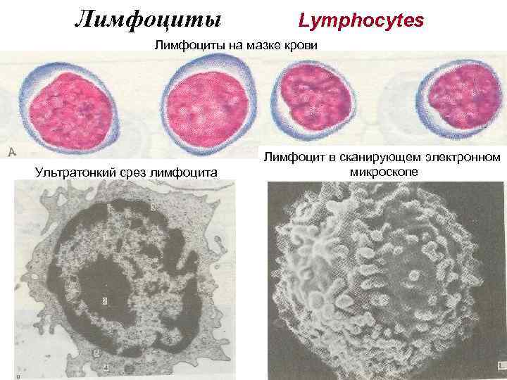 Лимфоциты фото под микроскопом