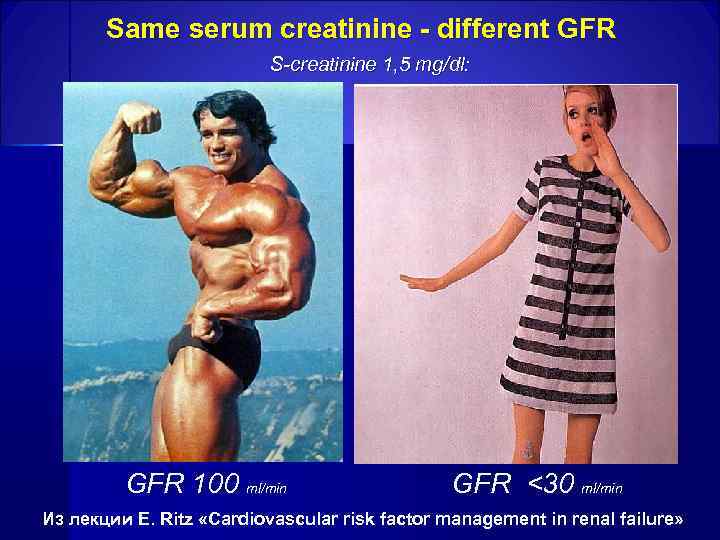  Same serum creatinine - different GFR S-creatinine 1, 5 mg/dl: GFR 100 ml/min
