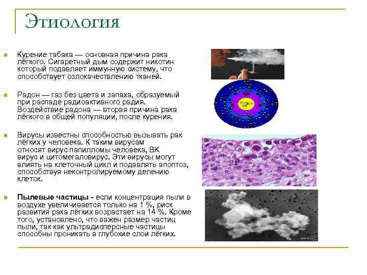  Этиология n Курение табака — основная причина рака лёгкого. Сигаретный дым содержит никотин
