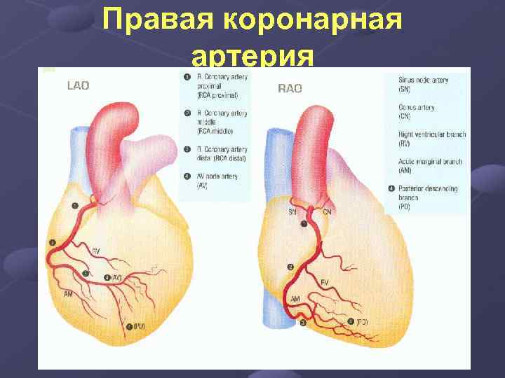 Правая коронарная артерия 