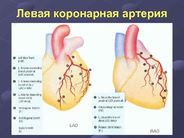 Левая коронарная артерия 