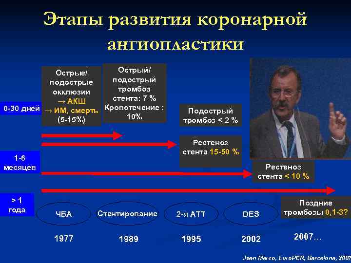  Этапы развития коронарной ангиопластики Острые/ Острый/ подострые подострый окклюзии тромбоз → АКШ стента: