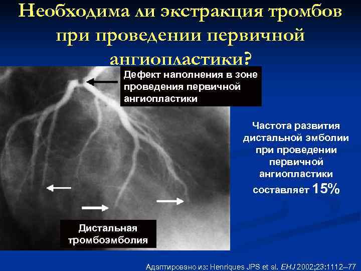 Коронарография фото с описанием патологии