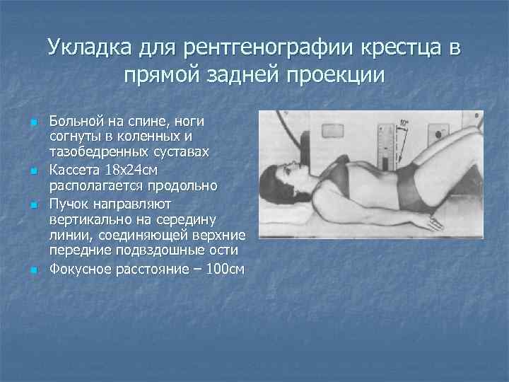 Рентген укладки в картинках и названия для рентгенолаборантов