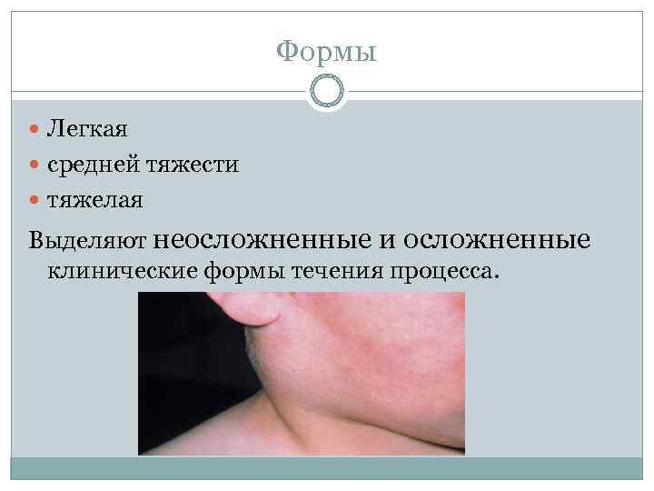     Формы  Легкая  средней тяжести  тяжелая Выделяют неосложненные