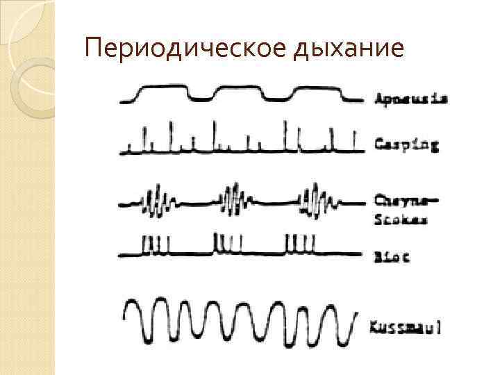 Изменение состава вдыхаемого  воздуха Горная болезнь, высотная болезнь, 