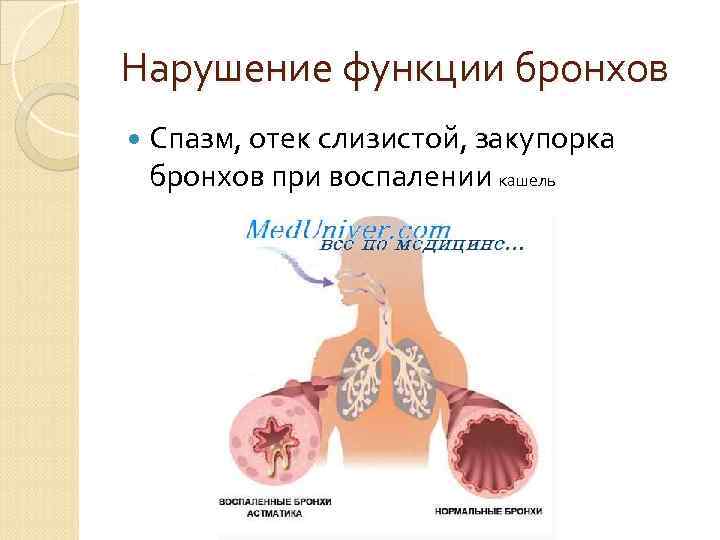  Нарушение структуры грудной  клетки Возникает при   врожденных   и