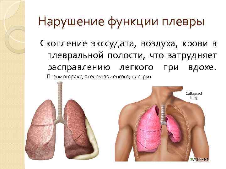  Нарушение кровообращения в   легких Идет нарушение соотношения между вентиляцией легких и