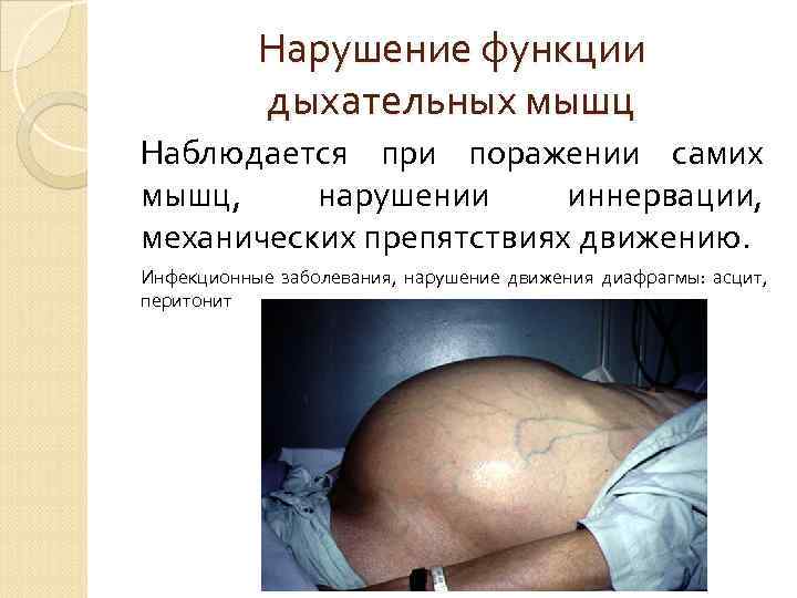    Гипоксия Патологическое состояние, наступающее в организме при неадекватном снабжении тканей и