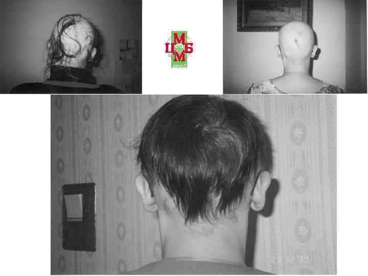 Спустя 7 месяцев Через год 