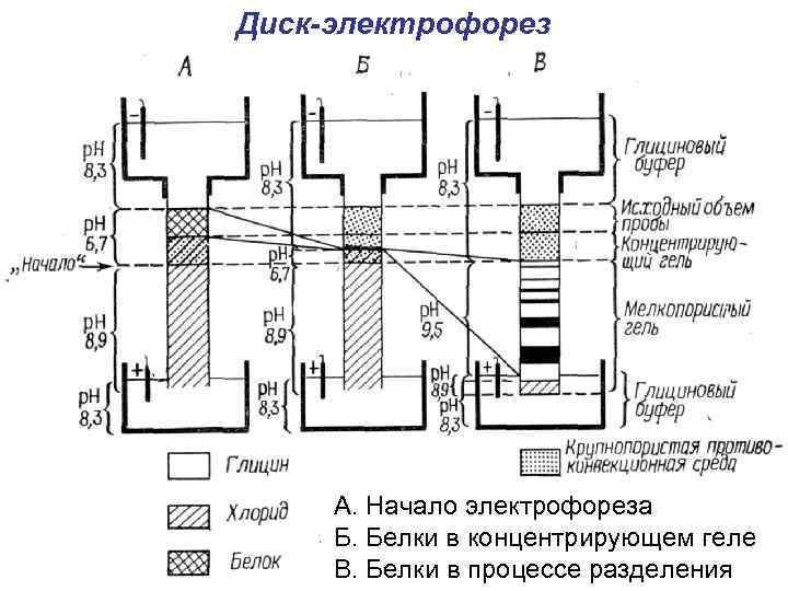 Диск-электрофорез А. Начало электрофореза Б. Белки в концентрирующем геле В. Белки в процессе разделения