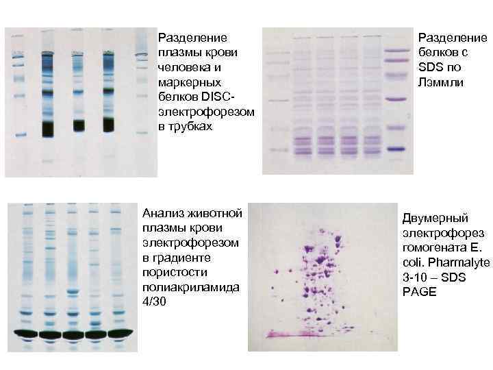 Разделение плазмы крови человека и маркерных белков DISCэлектрофорезом в трубках Анализ животной плазмы крови