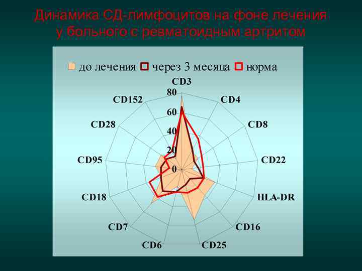  С-м Шегрена - системное аутоиммунное забо-  левание, характеризующееся лимфоплазмокле-  точной инфильтрацией