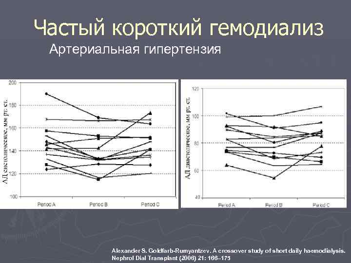 Частый короткий гемодиализ Артериальная гипертензия   Alexander S. Goldfarb-Rumyantzev. A crossover study of