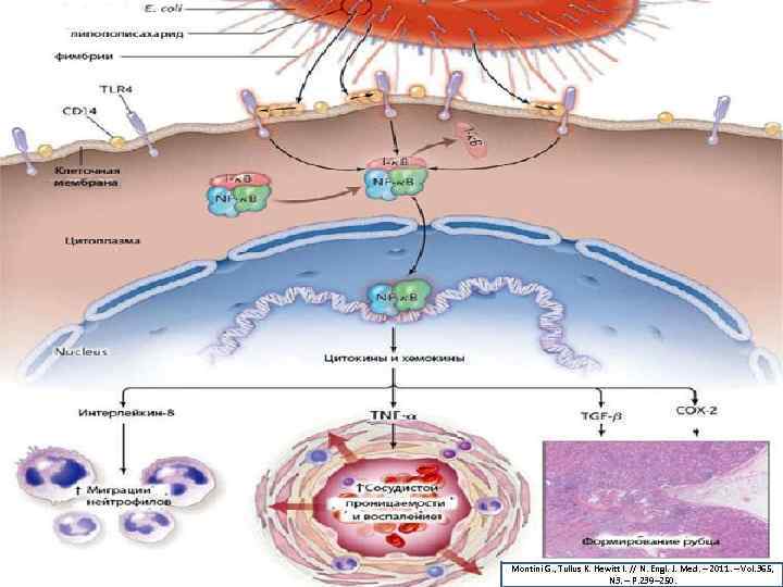 Montini G. , Tullus K. Hewitt I. // N. Engl. J. Med. – 2011.