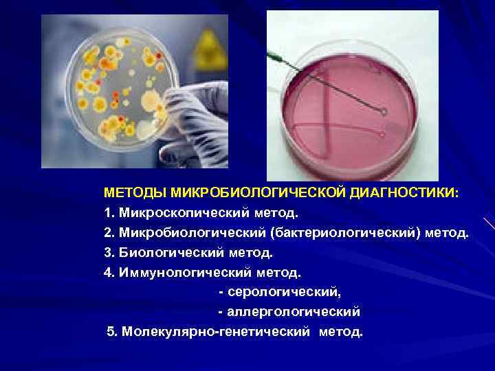 МЕТОДЫ МИКРОБИОЛОГИЧЕСКОЙ ДИАГНОСТИКИ: 1. Микроскопический метод. 2. Микробиологический (бактериологический) метод. 3. Биологический метод. 4.