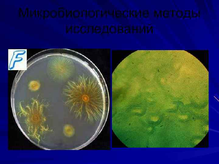 Микробиологические методы исследований 