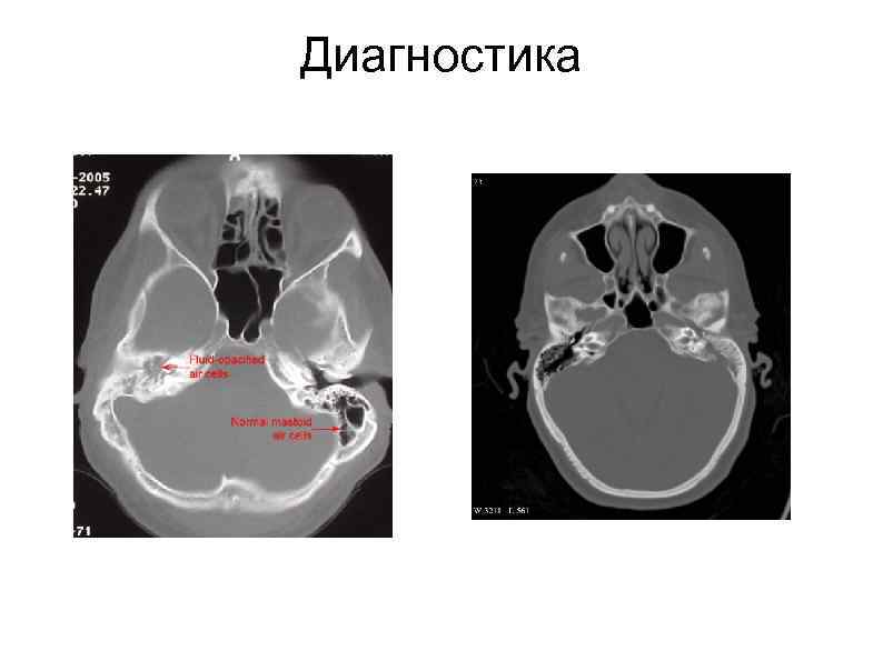Диагностика 