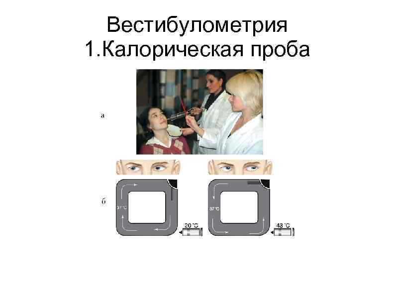  Вестибулометрия 1. Калорическая проба 