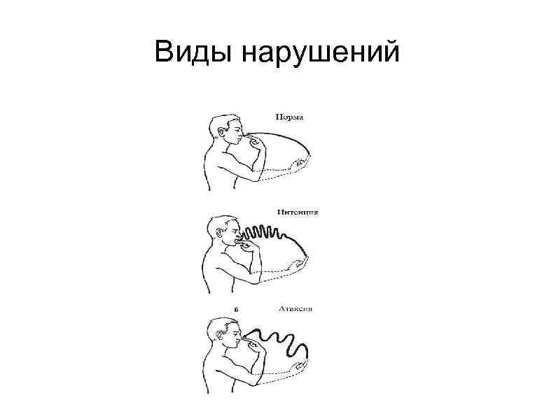 Виды нарушений 