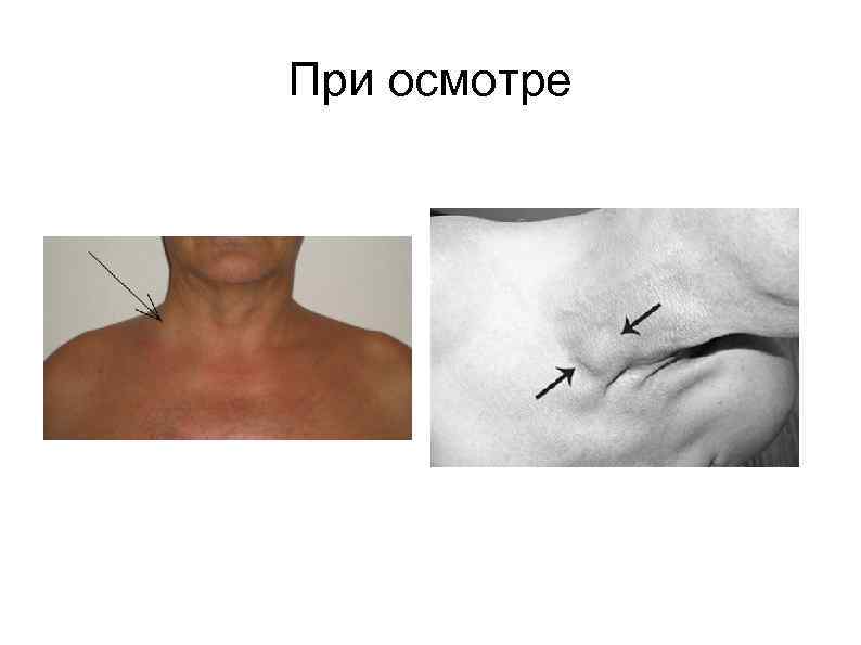 При осмотре 