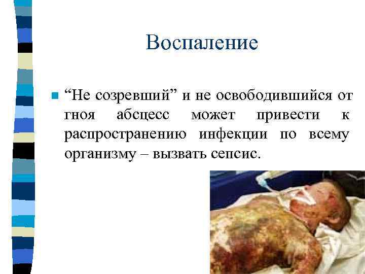 Воспаление  n  “Не созревший” и   не   освободившийся 
