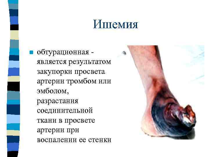    КРОВОТЕЧЕНИЯ n Одним из основных свойств крови является способность к “самозащите”