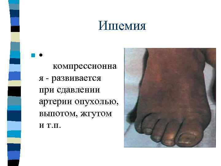    КРОВОТЕЧЕНИЯ n  Тромбоциты и тонкие слои фибрина изнутри заклеивают поврежденное