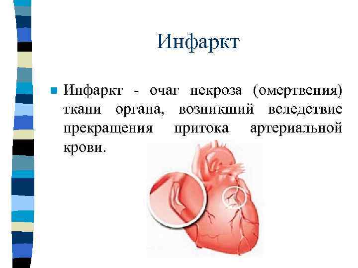     Тромбоз n  Тромбоз - процесс прижизненного выделения из крови