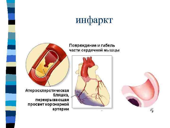     Тромбоз n  Условия образования тромбов: n  - нарушение