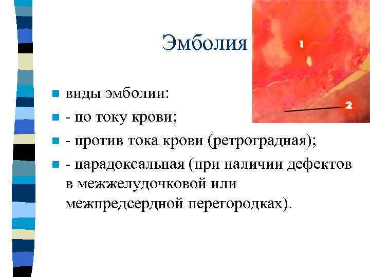 4 основных механизма развития дистрофий:   • 1.  инфильтрация - избыточное 