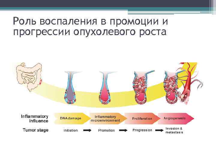 Подпишите картинки виды опухолевого роста