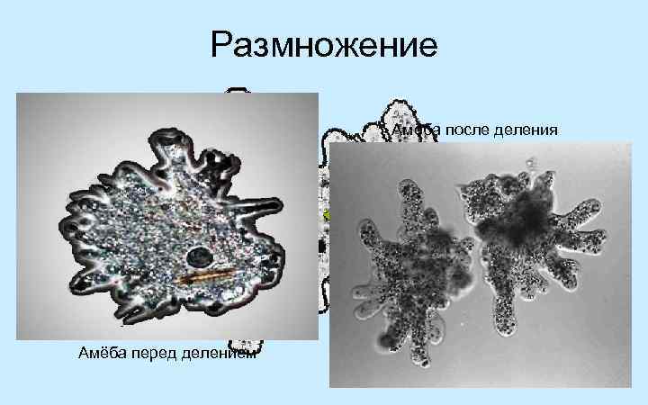 Схема классификации ротовой амебы