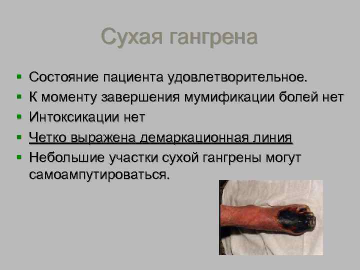 Сухая гангрена 
