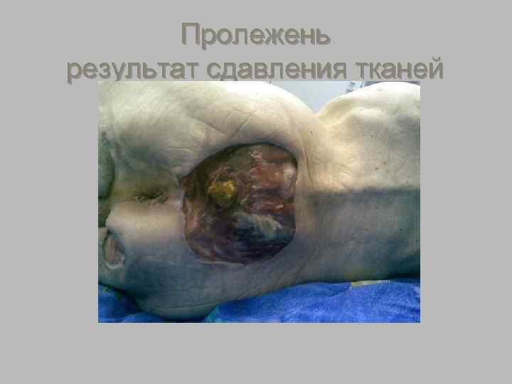    язвы § Язва (лат. ulcus, -eris, n. ) —  глубокий